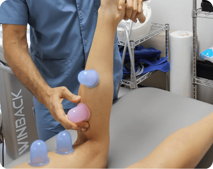 Cupping